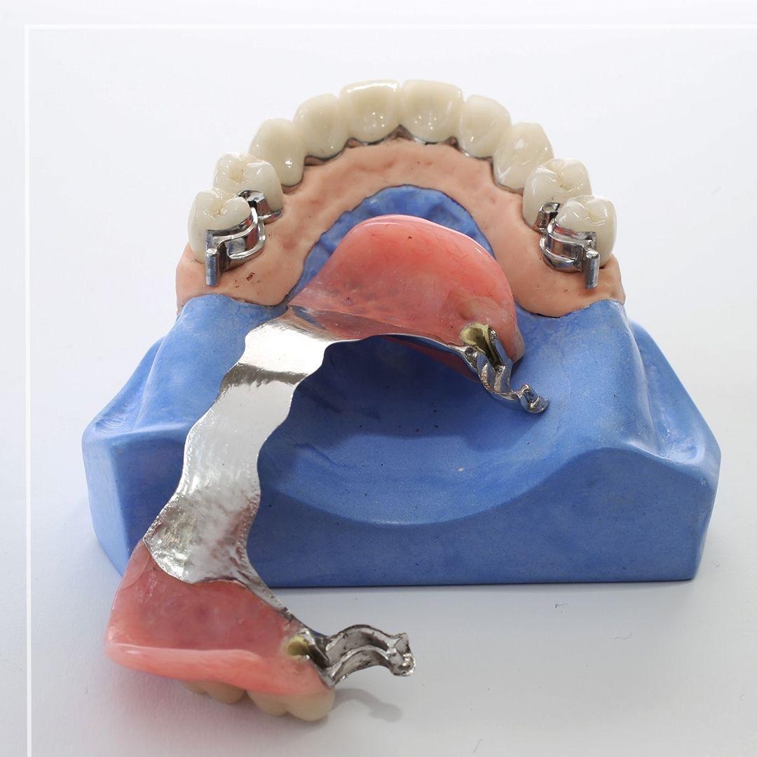 S L Super Ceramic Dental Lab - Precision. Quality. Aesthetic Smiles.