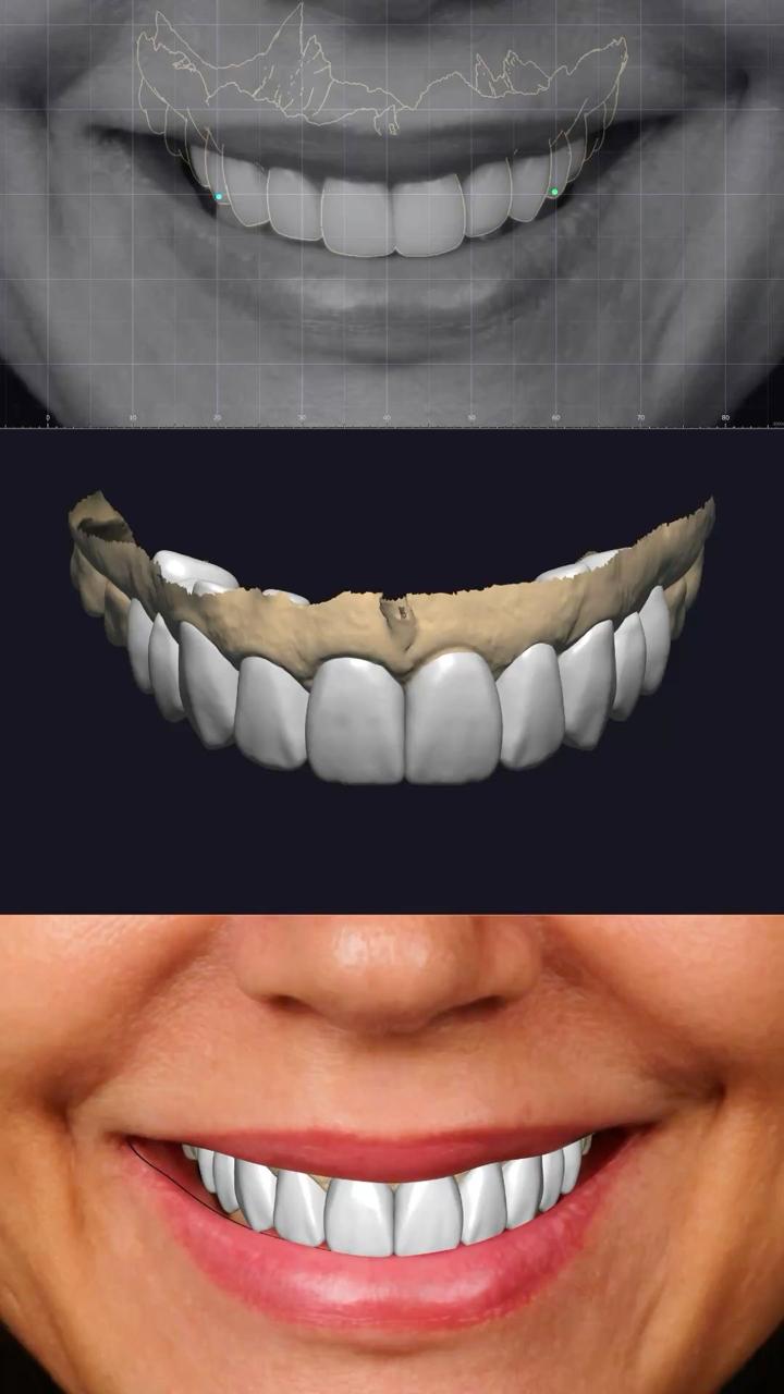 S L Super Ceramic Dental Lab - Precision. Quality. Aesthetic Smiles.